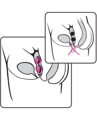 Joyballs schnurlose Geisha Balls (Pink & Schwarz) - Joydivision